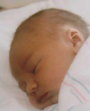 loc lgp birthfrischpic