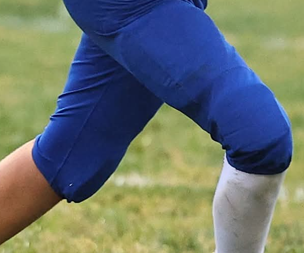 sj easton alpers